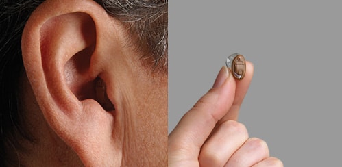 Types Of Hearing Aids